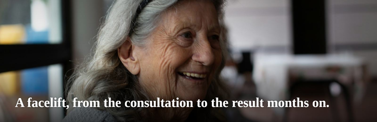 A facelift, from the consultation to the result months on.